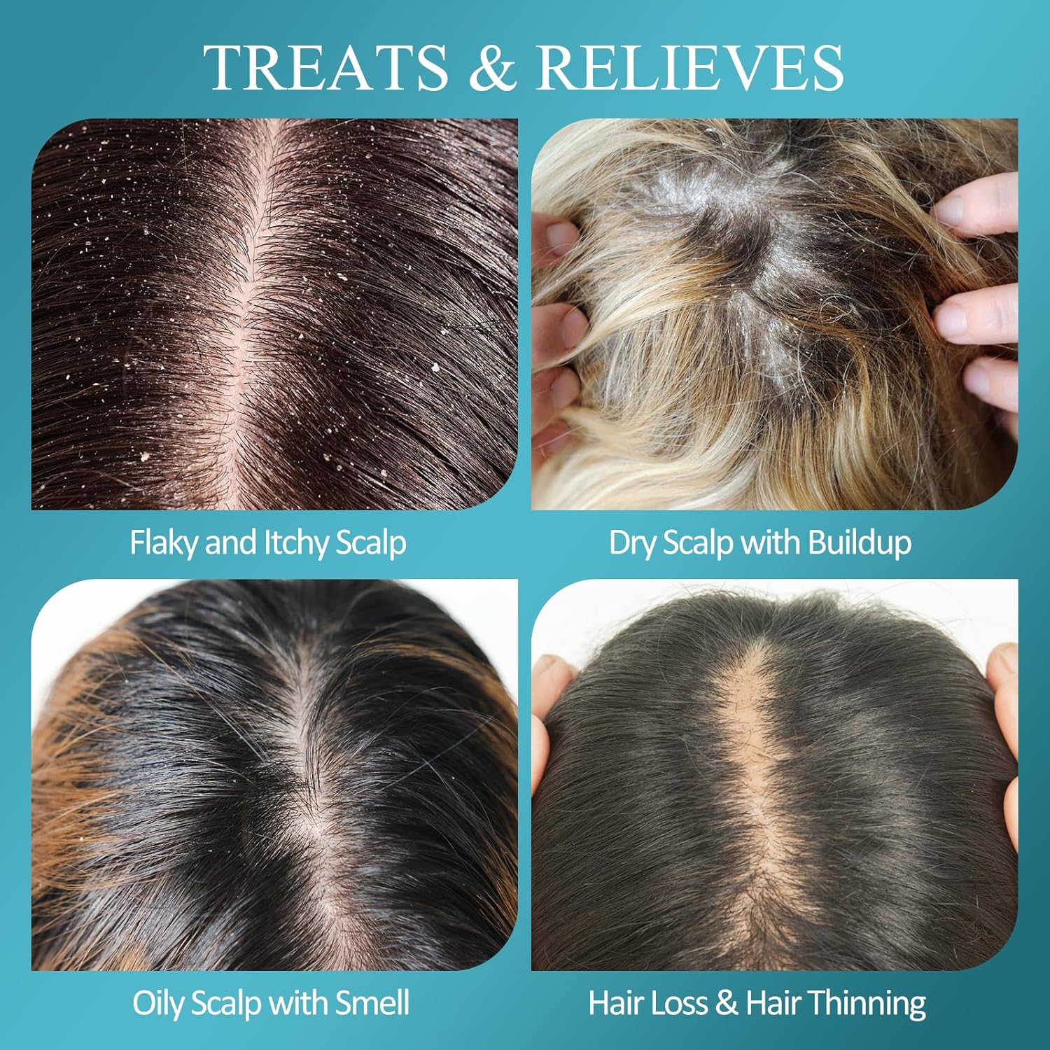 Biotin Scalp Scrub & Detox Shampoo (2-in-1)