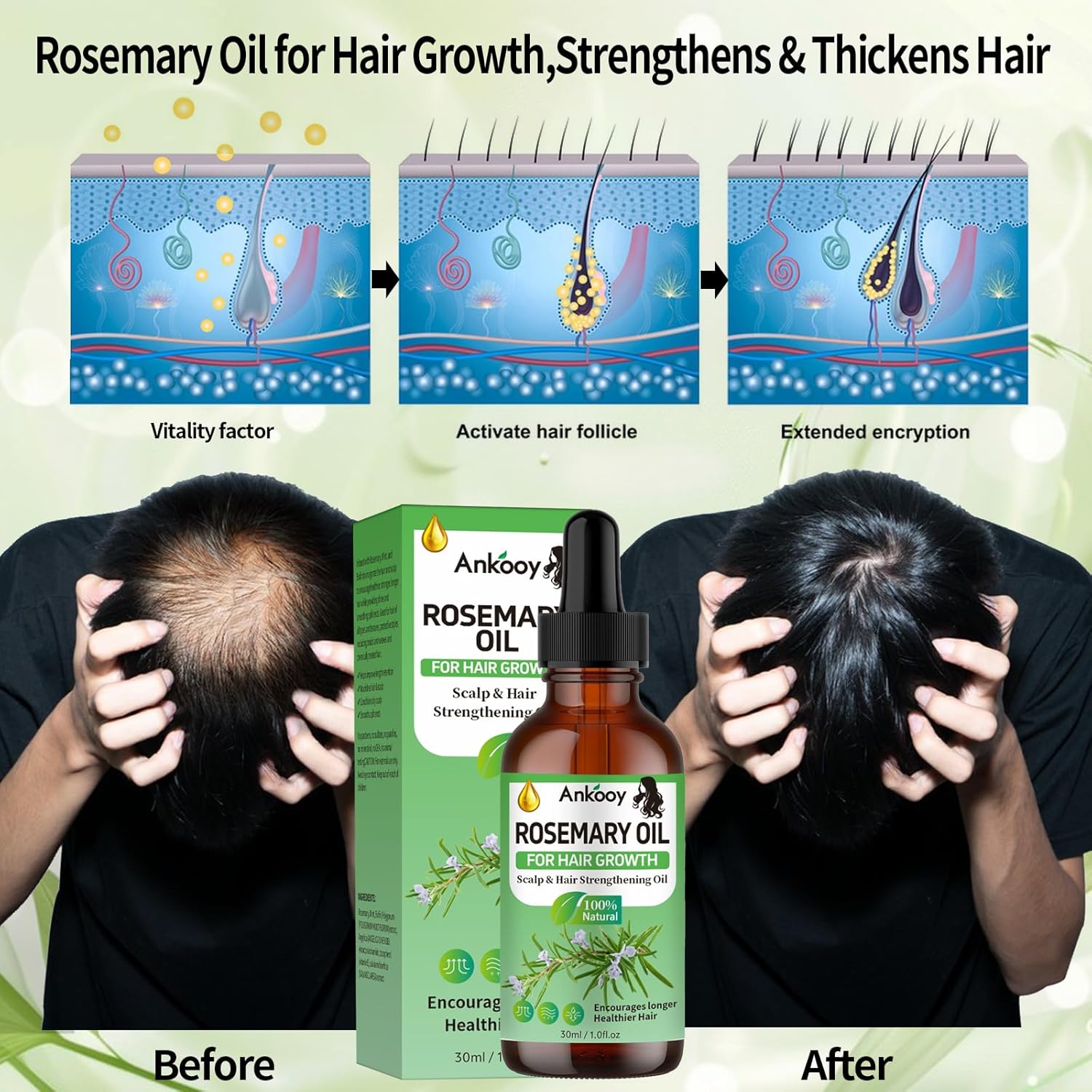 Rosemary Hair Growth Oil – 3 Pack