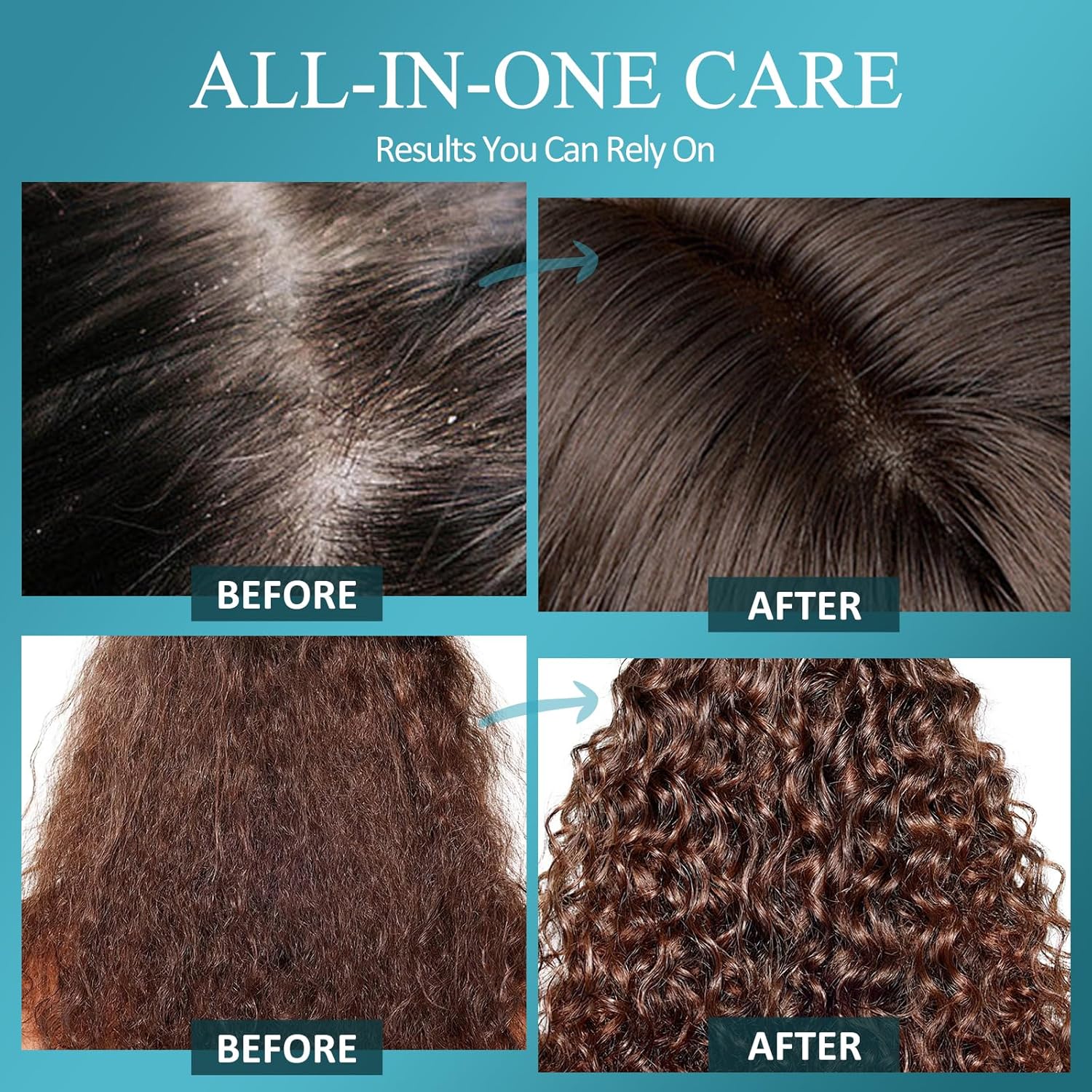 Biotin Scalp Scrub & Detox Shampoo (2-in-1)