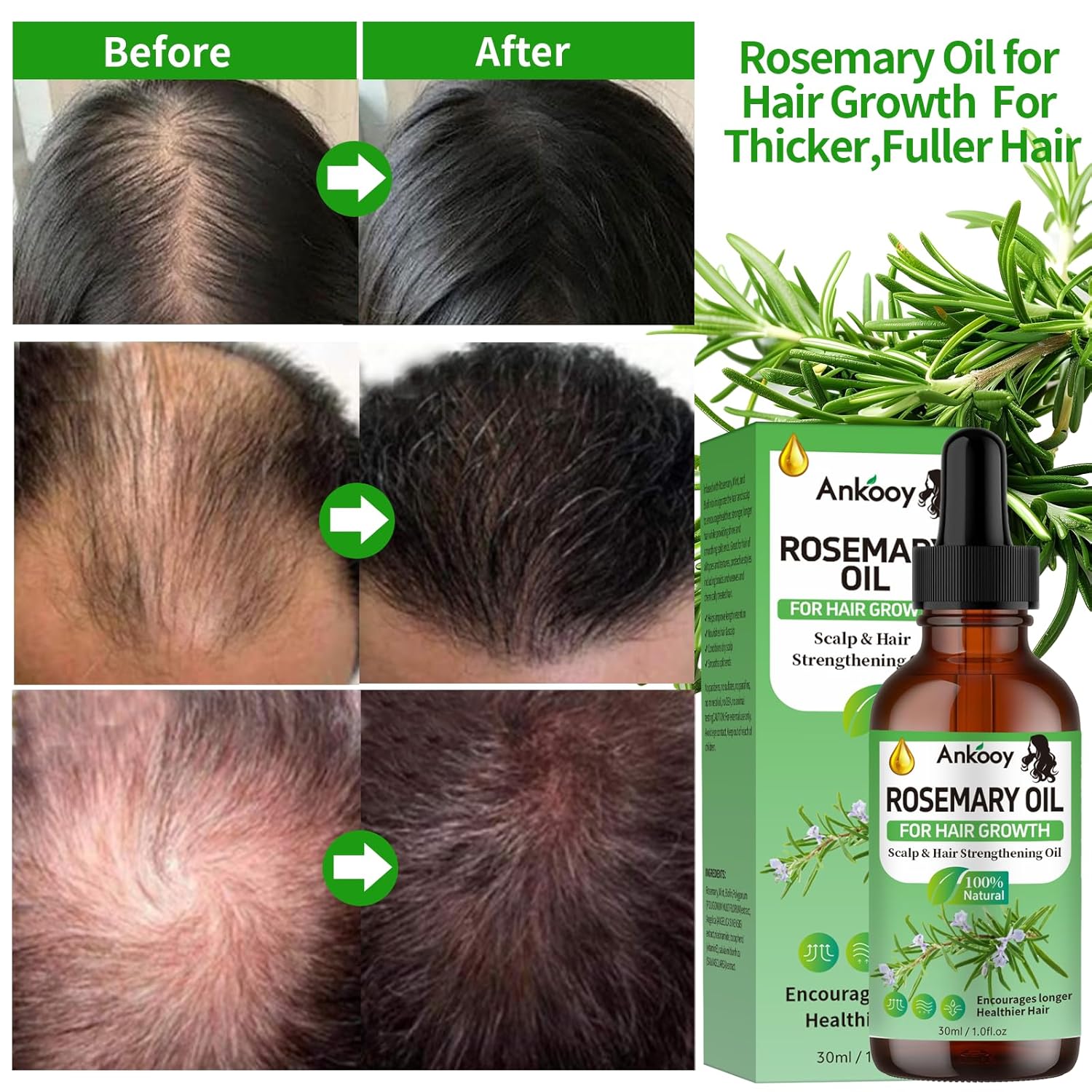 Rosemary Hair Growth Oil – 3 Pack